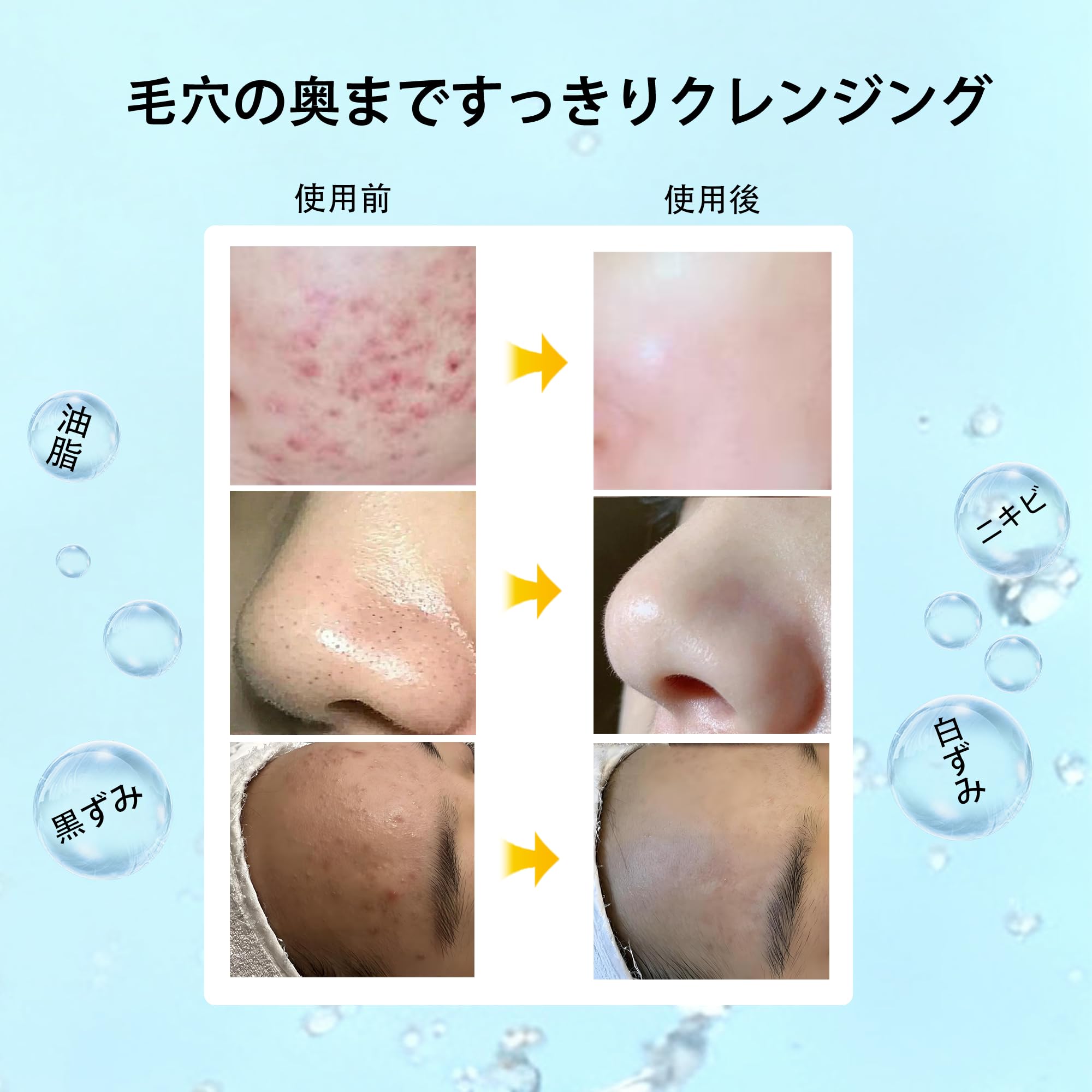 Amazon.co.jp: 毛穴吸引器 強力 6種類ヘッド 3段階吸引力調整 最大